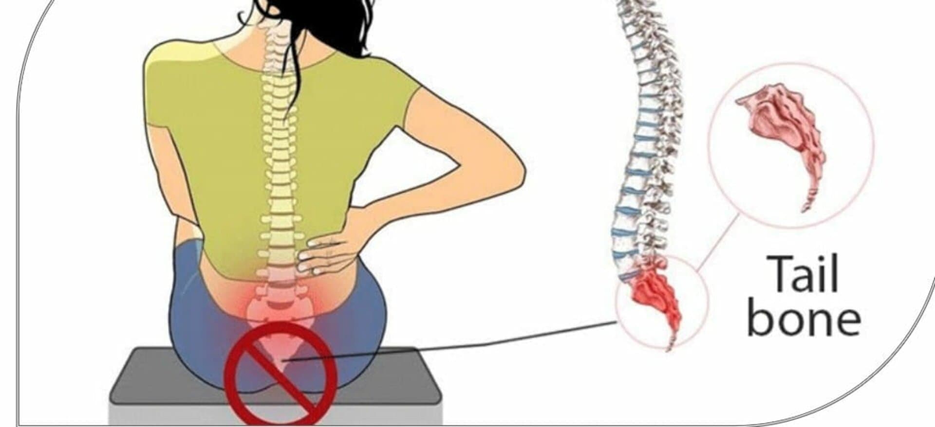 ألم العصعص | عجز الذنب