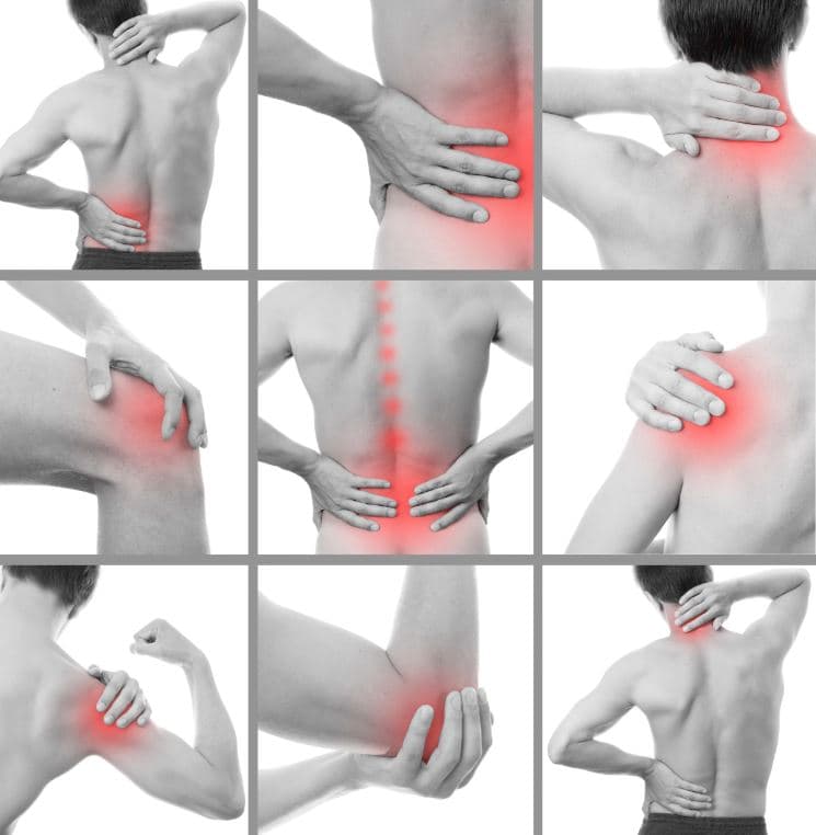 متلازمة الألم العضلي اللفافي | لفافة العضلة