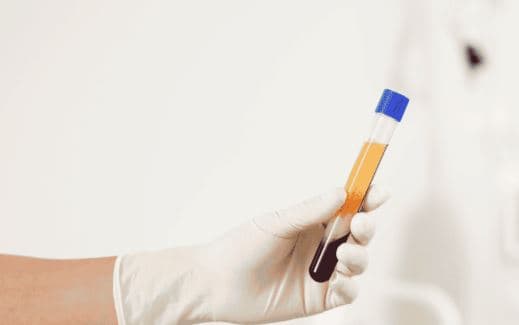 البلازما الغنية بالصفائح الدموية